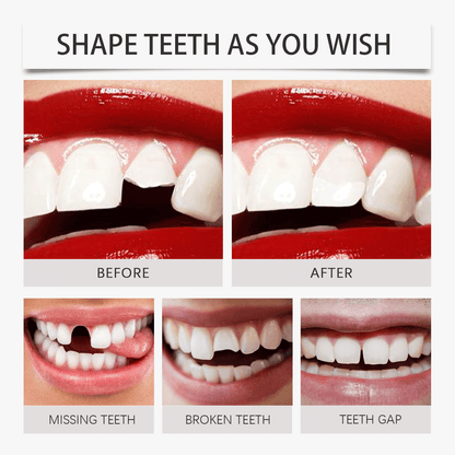 CYNOSUREAN Moldable Dental Gel Dentures Temporary Fillings Cavities and Teeth Fillings Temporary Tooth Filling Denture Kit Oral false tooth fake